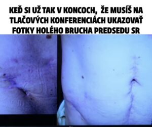 Vládna koalícia sa už viac ako rok zaoberá sama sebou namiesto riešenia problémov ľudí